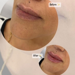 ������� ����������� � �������