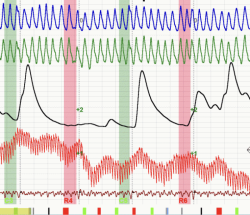 �������� ���� �� ��������� ���: ����� �� ��������?